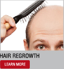 baldness & hair regrowth treatment | stem cell treatment